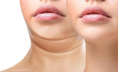 7 Güçlü Yüz Yogası Egzersiziyle Doğal Yoldan Çift Gıdıdan Kurtulun